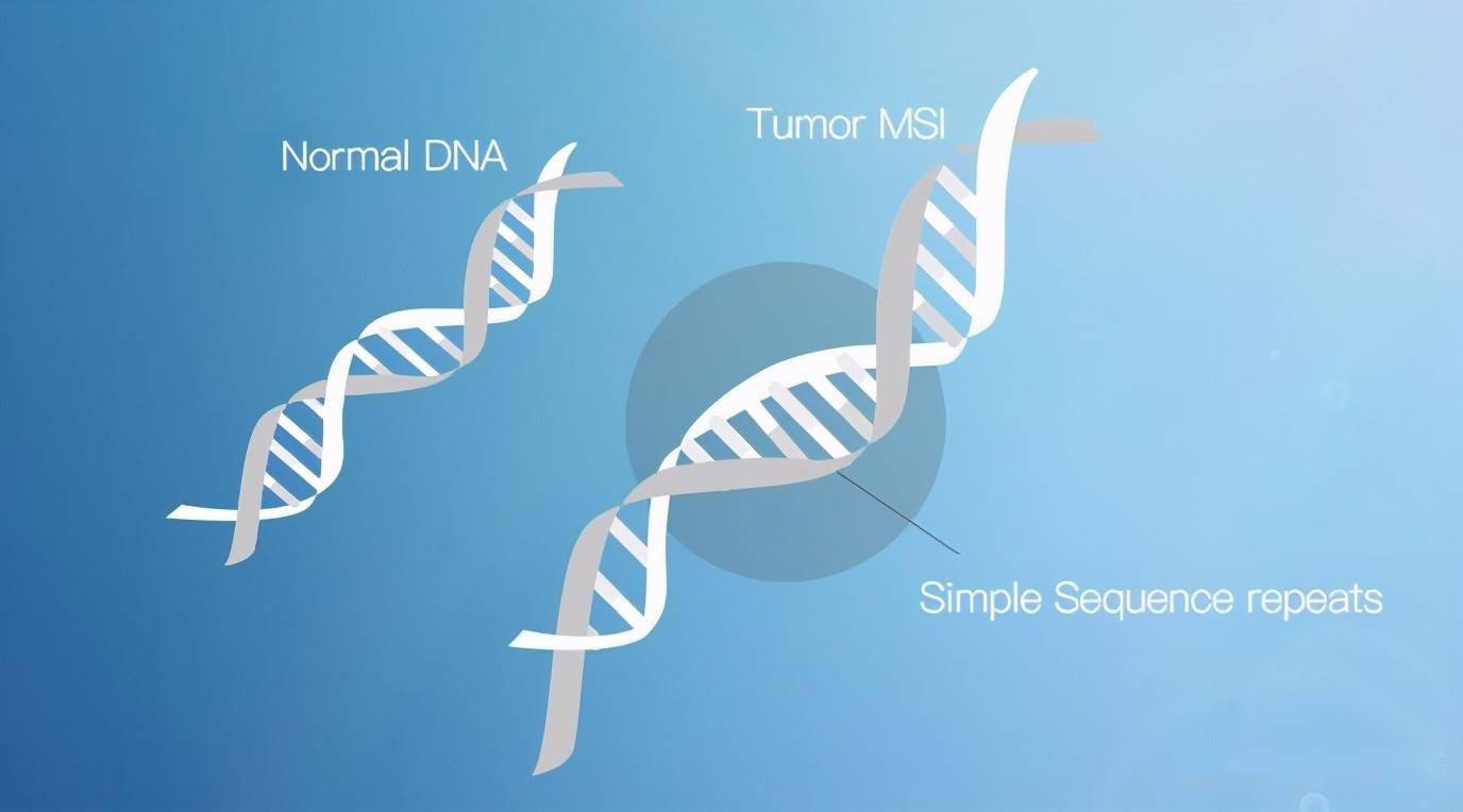 MSI微卫星不稳定检测