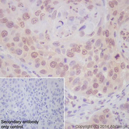 CDK4