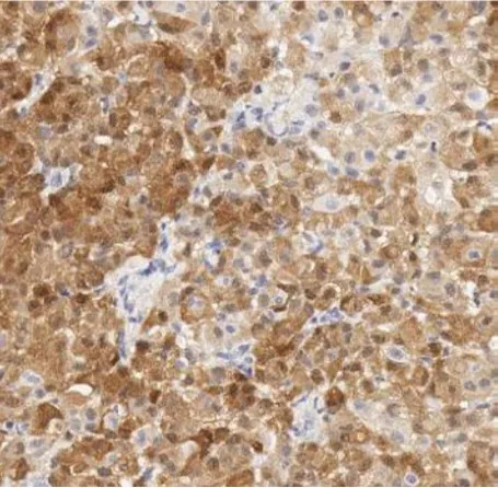 Calretinin