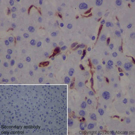 Galectin-3