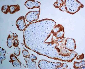 HCG-β