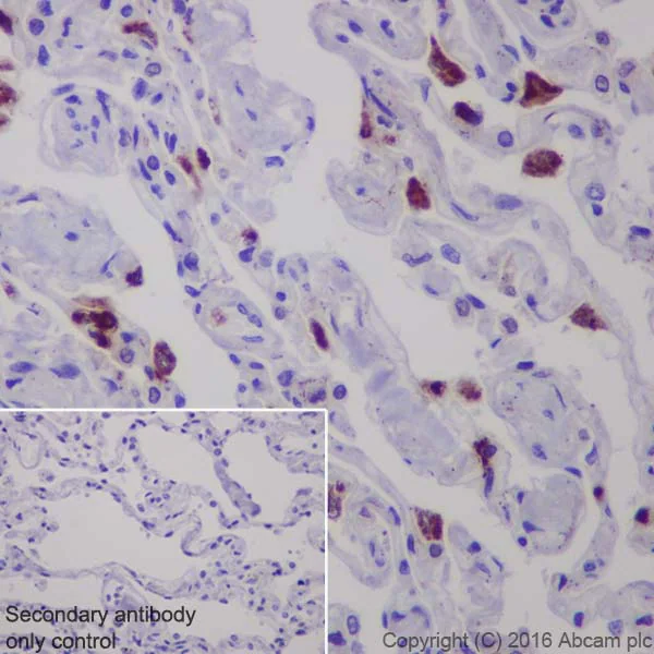 Lysozyme
