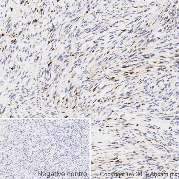 Myogenin