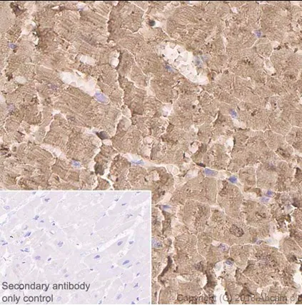 Myoglobin