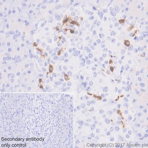 Somatostatin-ihc