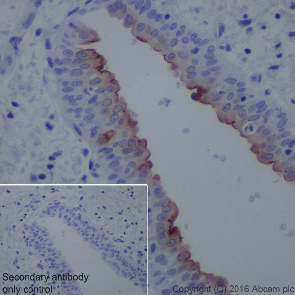 Uroplakin II