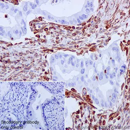Vimentin