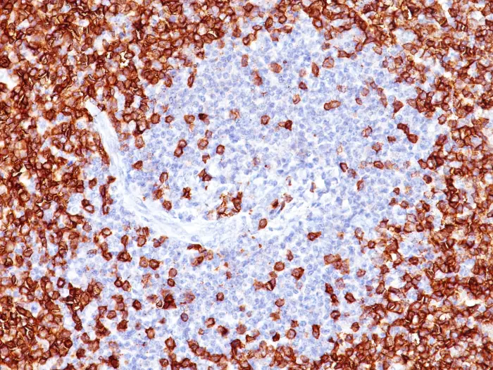 cd45ro