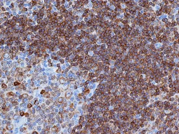 cd79a
