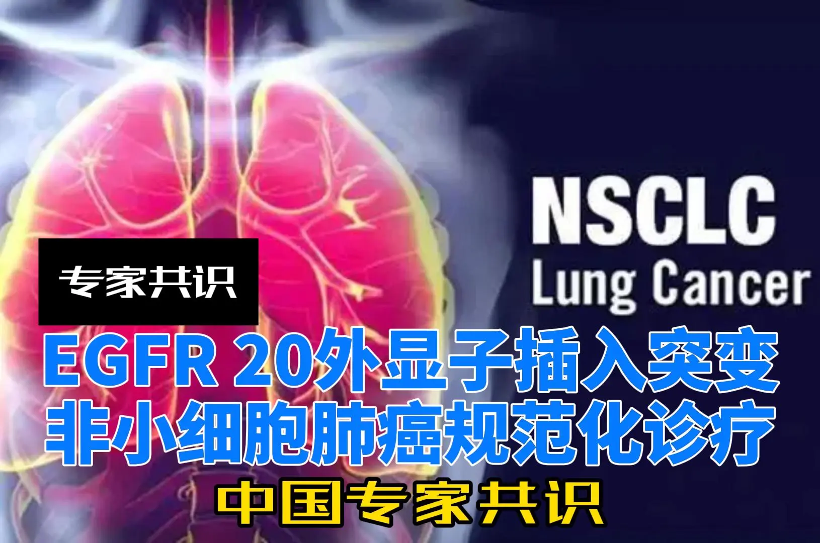 EGFR ex20ins突变NSCLC诊疗中国专家共识(2023)