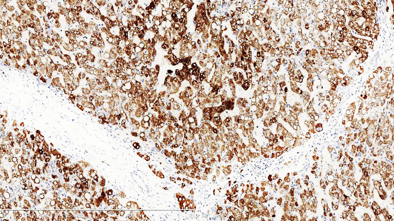 Hepatocyte