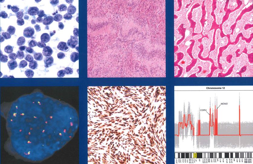 2020 WHO 5th 软组织肿瘤分类