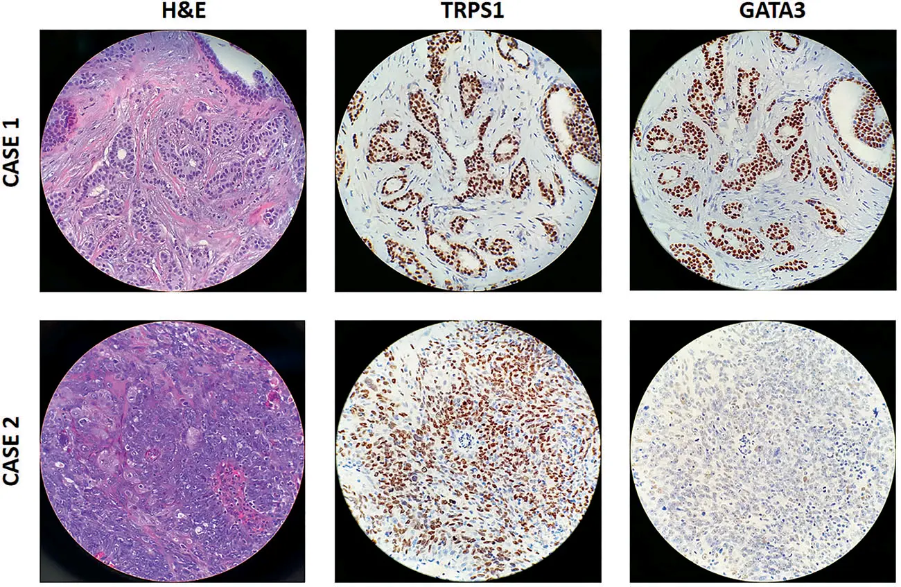 trps1-2