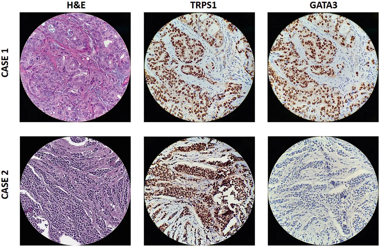 trps1-3
