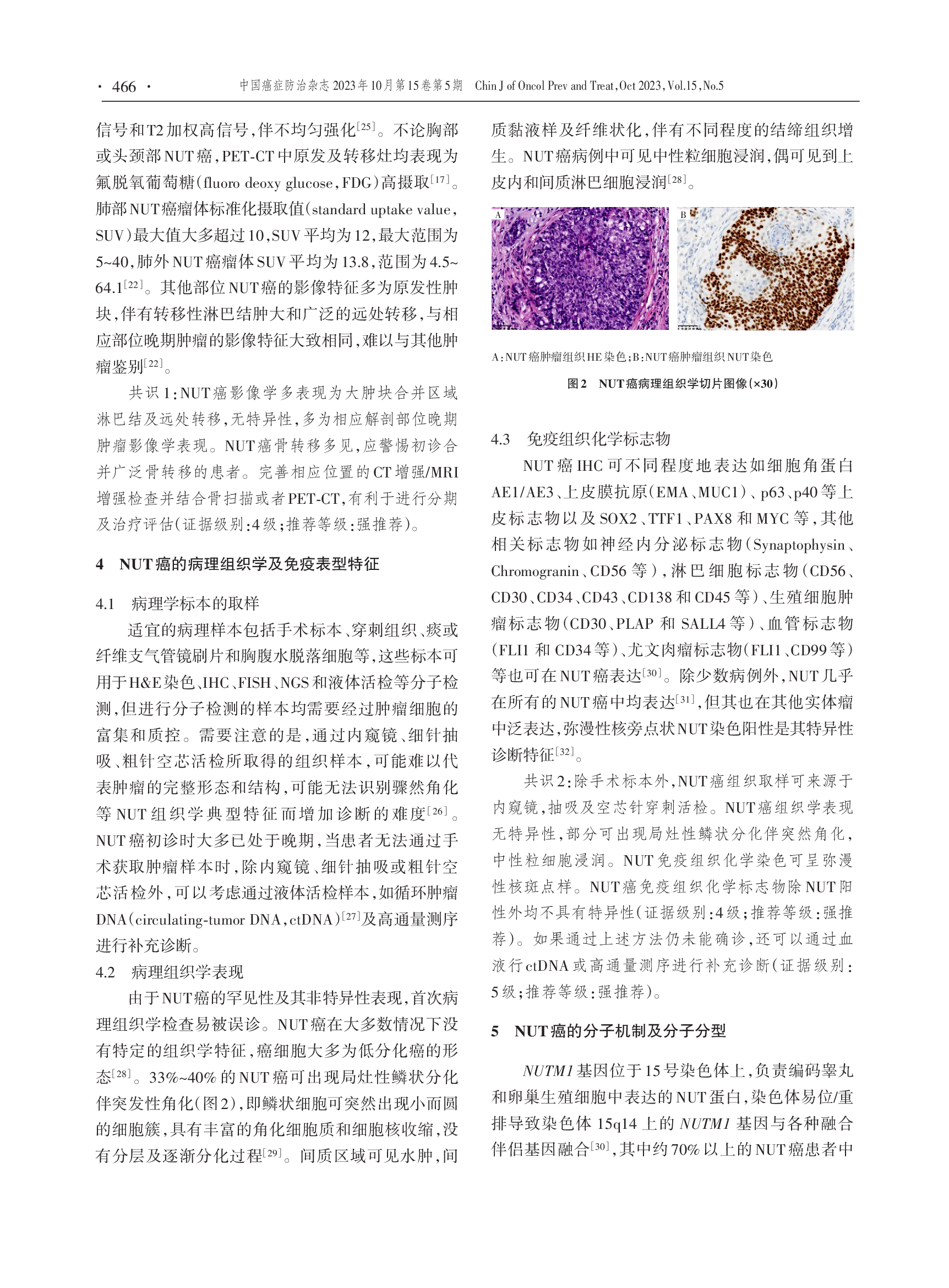 中线(NUT)癌诊断与治疗专家共识（2023版）-004.png