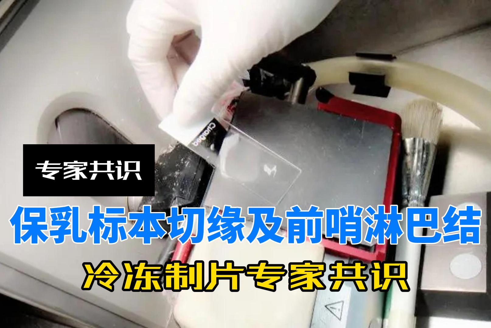 保乳标本乳腺切缘及前哨淋巴结冷冻制片专家共识