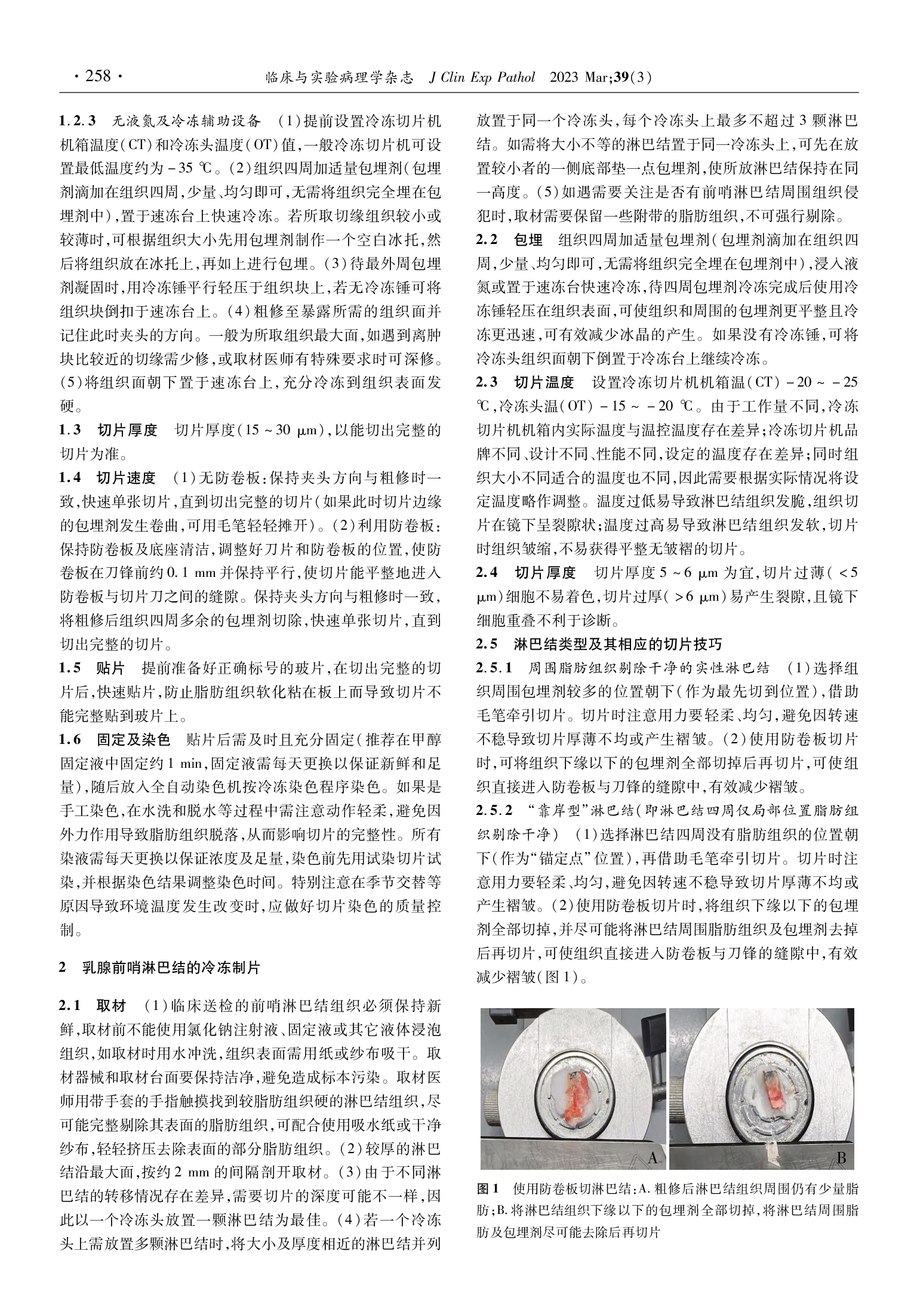 保乳标本乳腺切缘及前哨淋巴结的冷冻制片专家共识（2023）-002.png