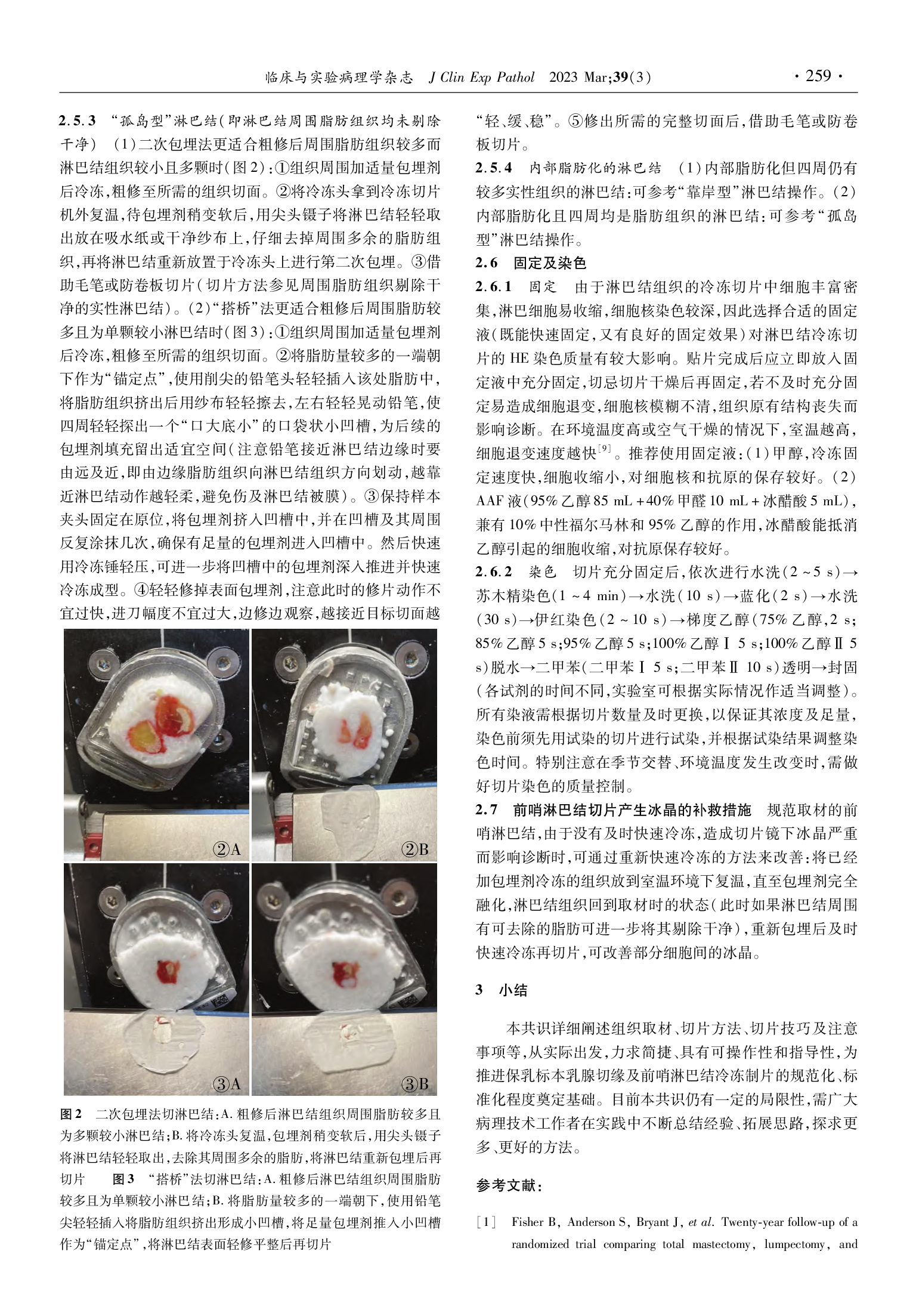 保乳标本乳腺切缘及前哨淋巴结的冷冻制片专家共识（2023）-003.png