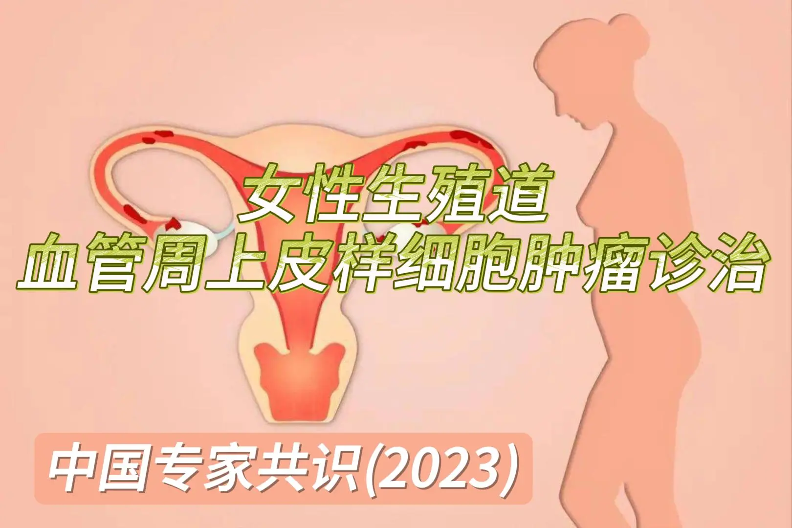 女性生殖道血管周上皮样细胞肿瘤诊治专家共识