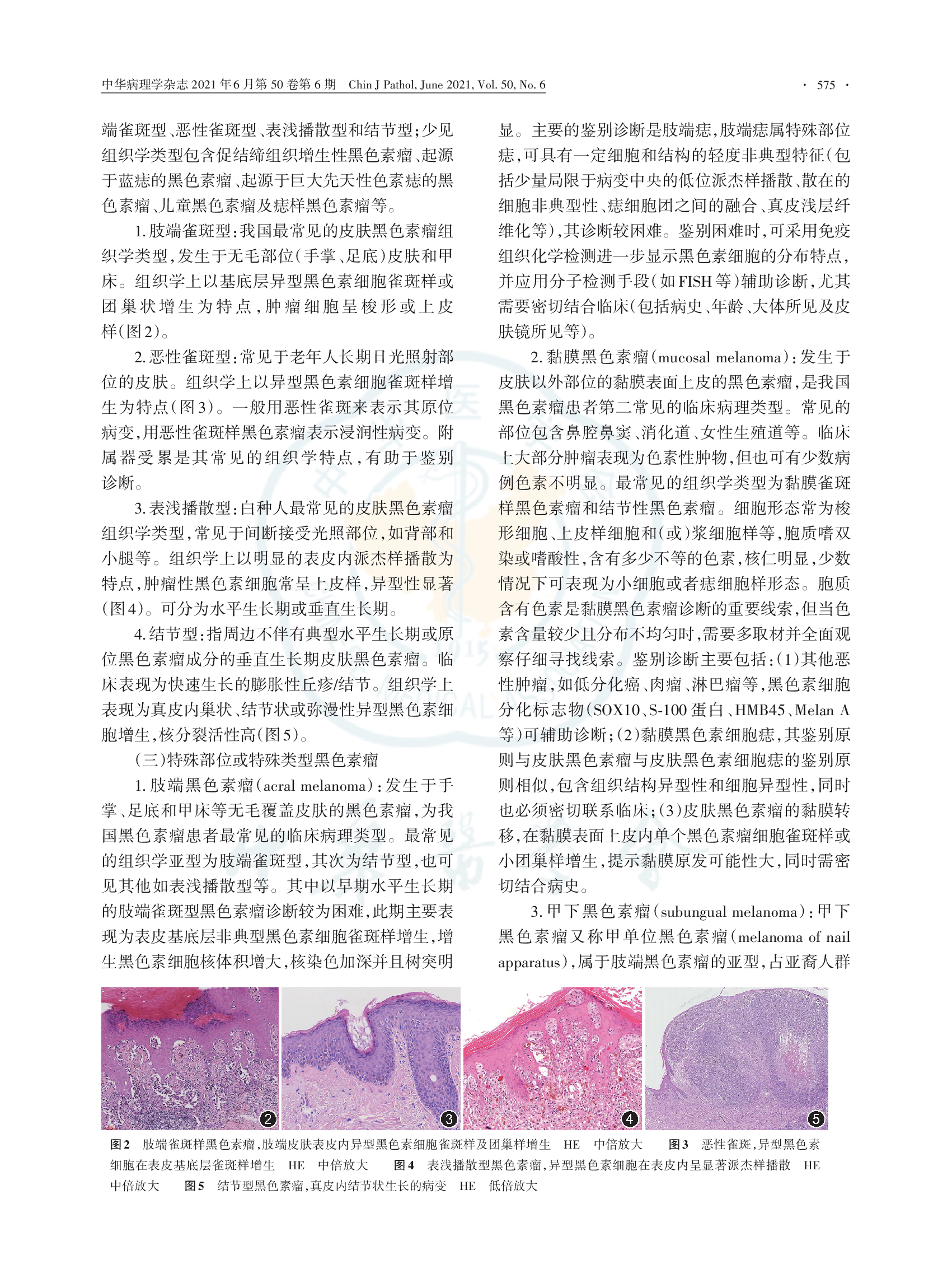 黑色素瘤病理诊断临床实践指南（2021版）-004.png